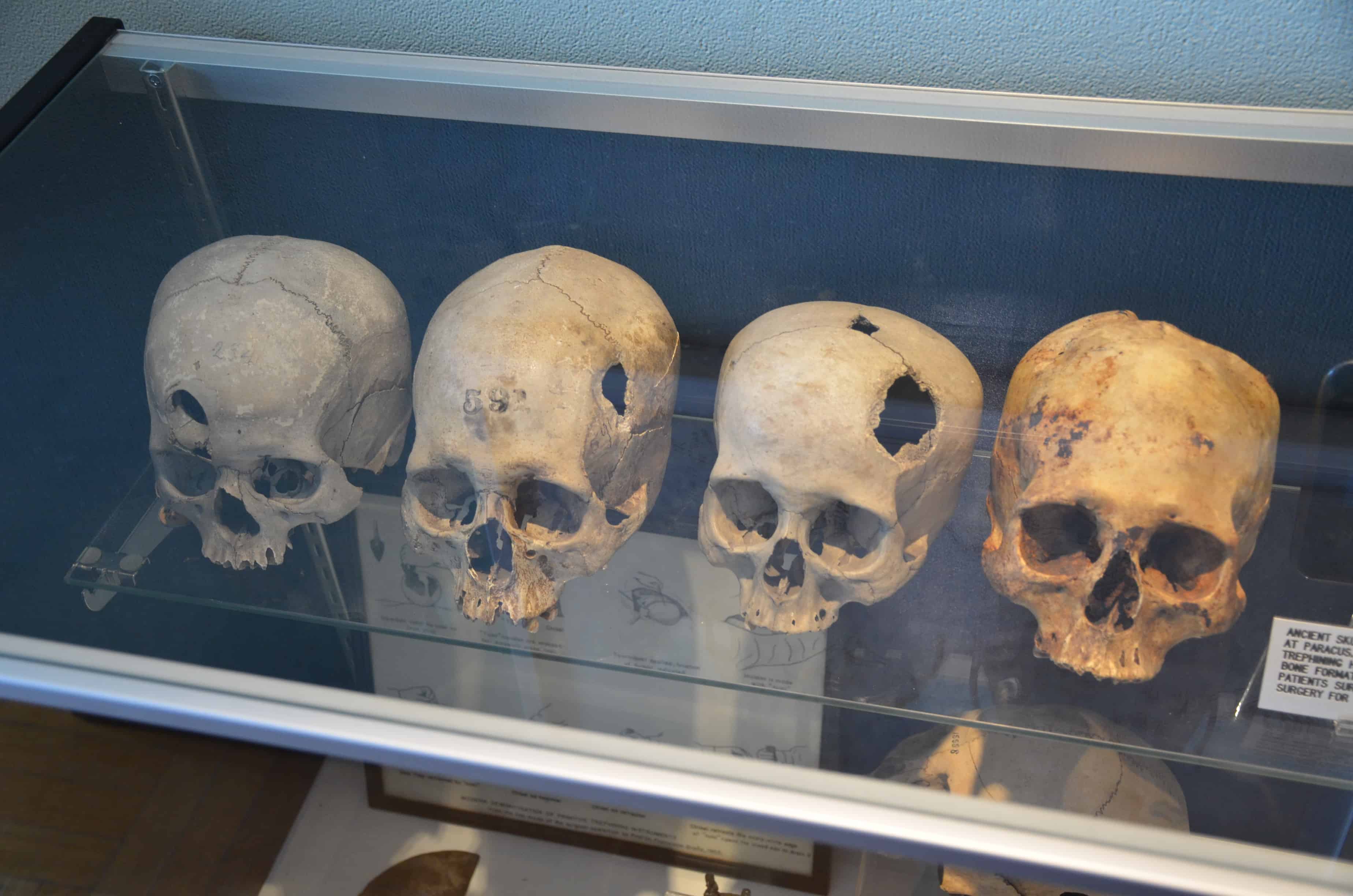 Peruvian skulls at the International Museum of Surgical Science in Gold Coast, Chicago
