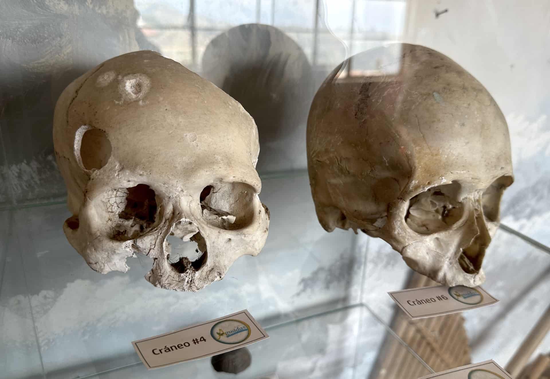 Skulls in the Indigenous Exhibit